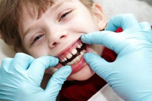 Child Teeth care