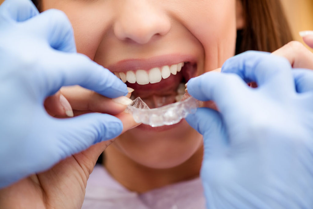 Channel Islands Family Dental Office | Dentist In Ventura County