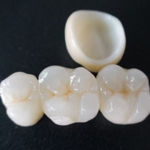 Zirconia
