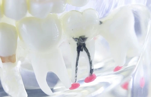 teeth model displays the root canal