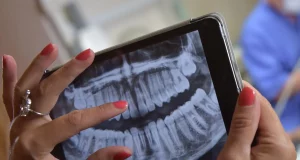 Dental X-Rays Vs Panoramic X-Rays