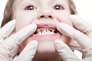 Why Are Dental Cavities in Toddlers Dangerous?