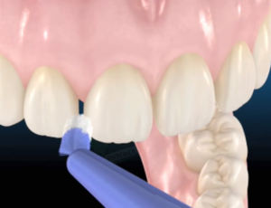 How To Use The Dental Floss Properly