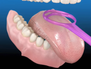 How To Use The Dental Floss Properly