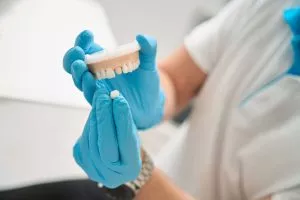 Molde de corona dental. Caries debajo de las coronas dentales