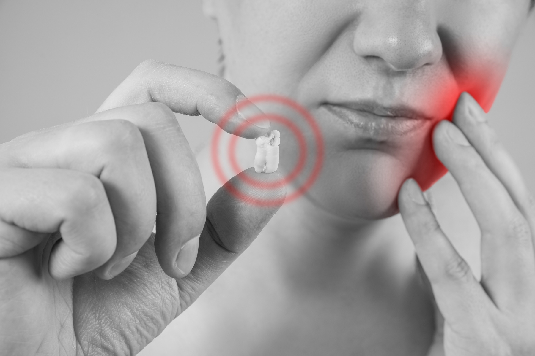 Can Wisdom Teeth Cause Migraines?