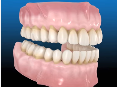 Dental
