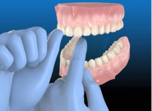 Dental floss