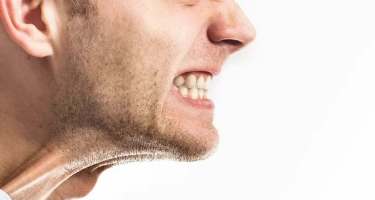 Epilepsy and Teeth Grinding