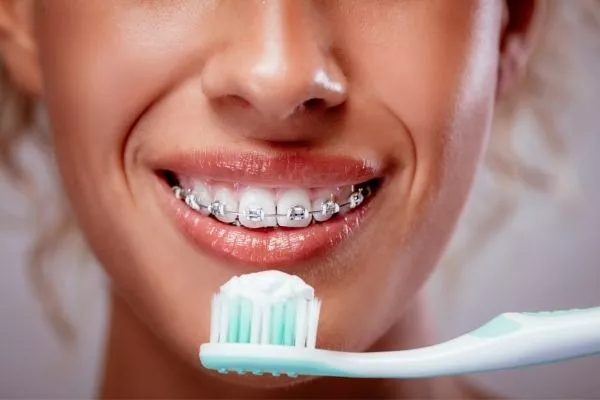 How to Brush your Teeth with Braces