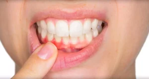 fix periodontal disease