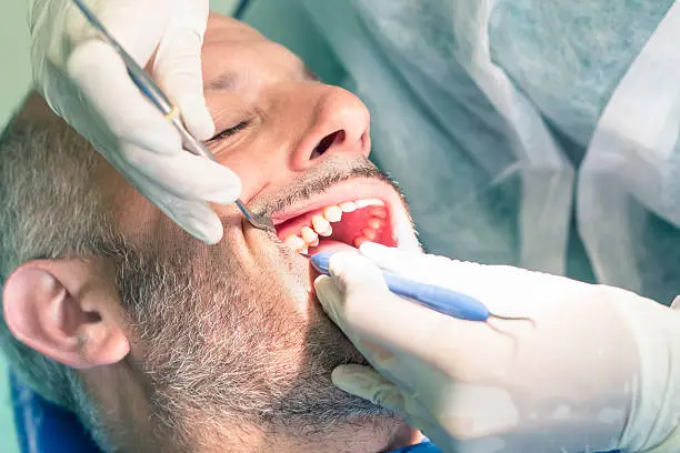 ¿Cómo revertir la periodontitis? Si la periodontitis ya se encuentra avanzada lo más probable es que requieras ir con el dentista.
