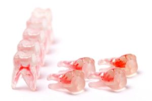 ROOT CANAL AND CANCER ROOT CANAL AND CANCER 