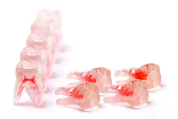 ROOT CANAL AND CANCER ROOT CANAL AND CANCER 