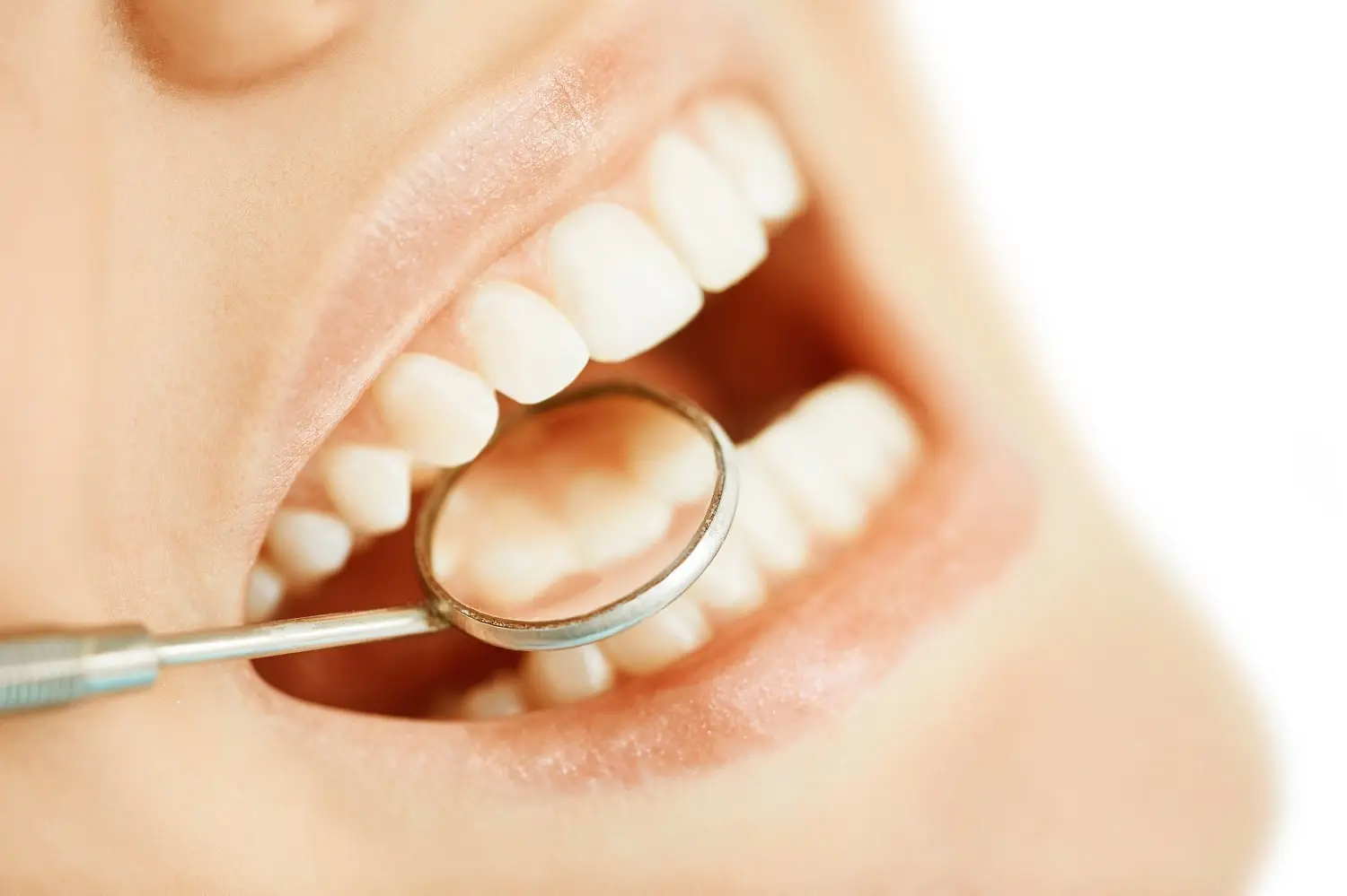 woman-getting-her-oral-health-checked