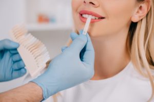 cropped view of male dentist matching teeth color of woman with palette in clinic, teeth whitening