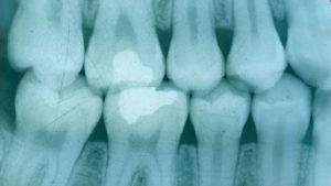 intraoral dental imaging