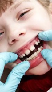 What to do When Your Child Loses a Tooth?