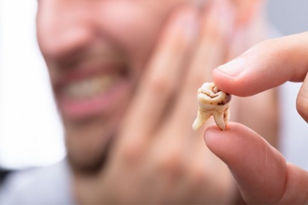 caries entre los dientes