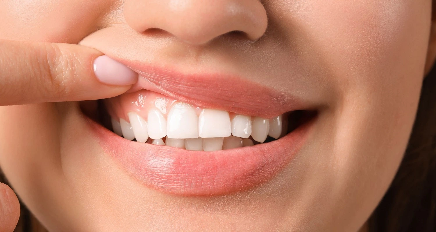 girl showing her healthy gums