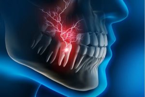 CHIPPED OR BROKEN TOOTH TREATMENT & REPAIR