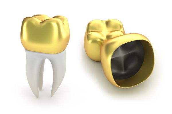 DENTAL CROWNS