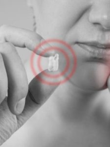 Wisdom tooth pain