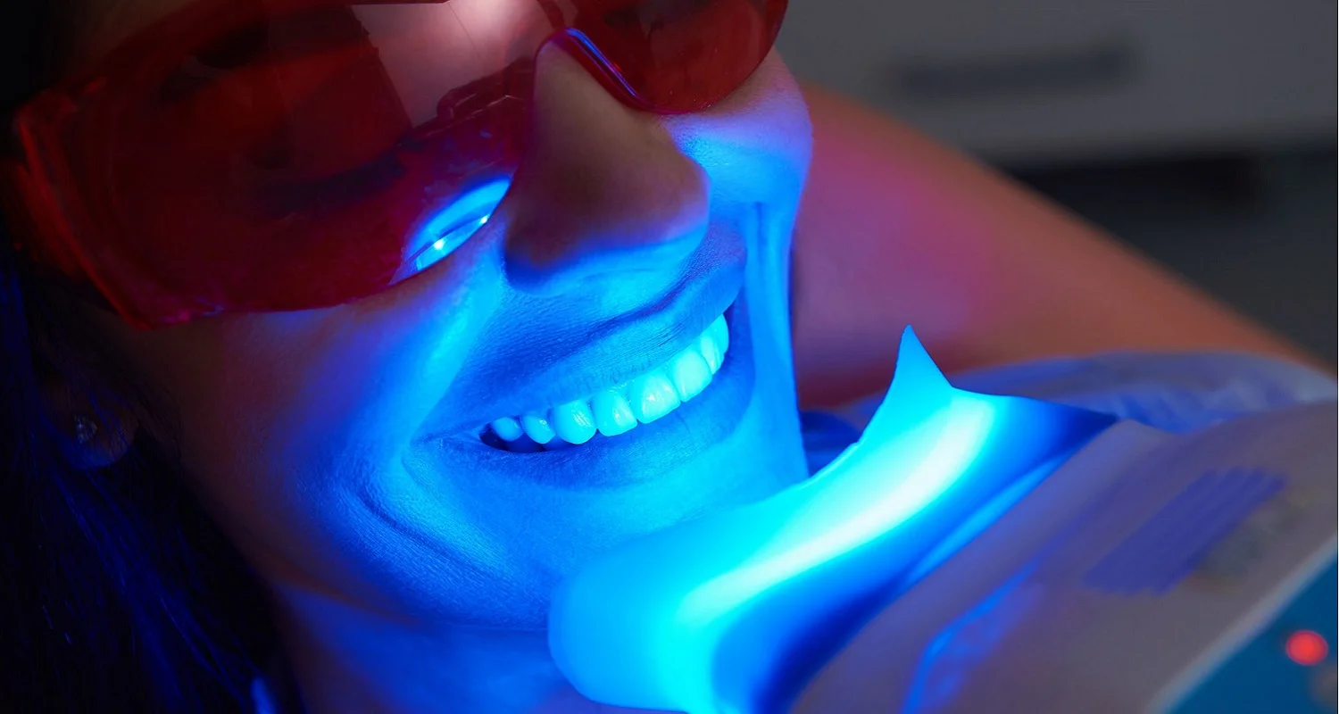 teeth whitening