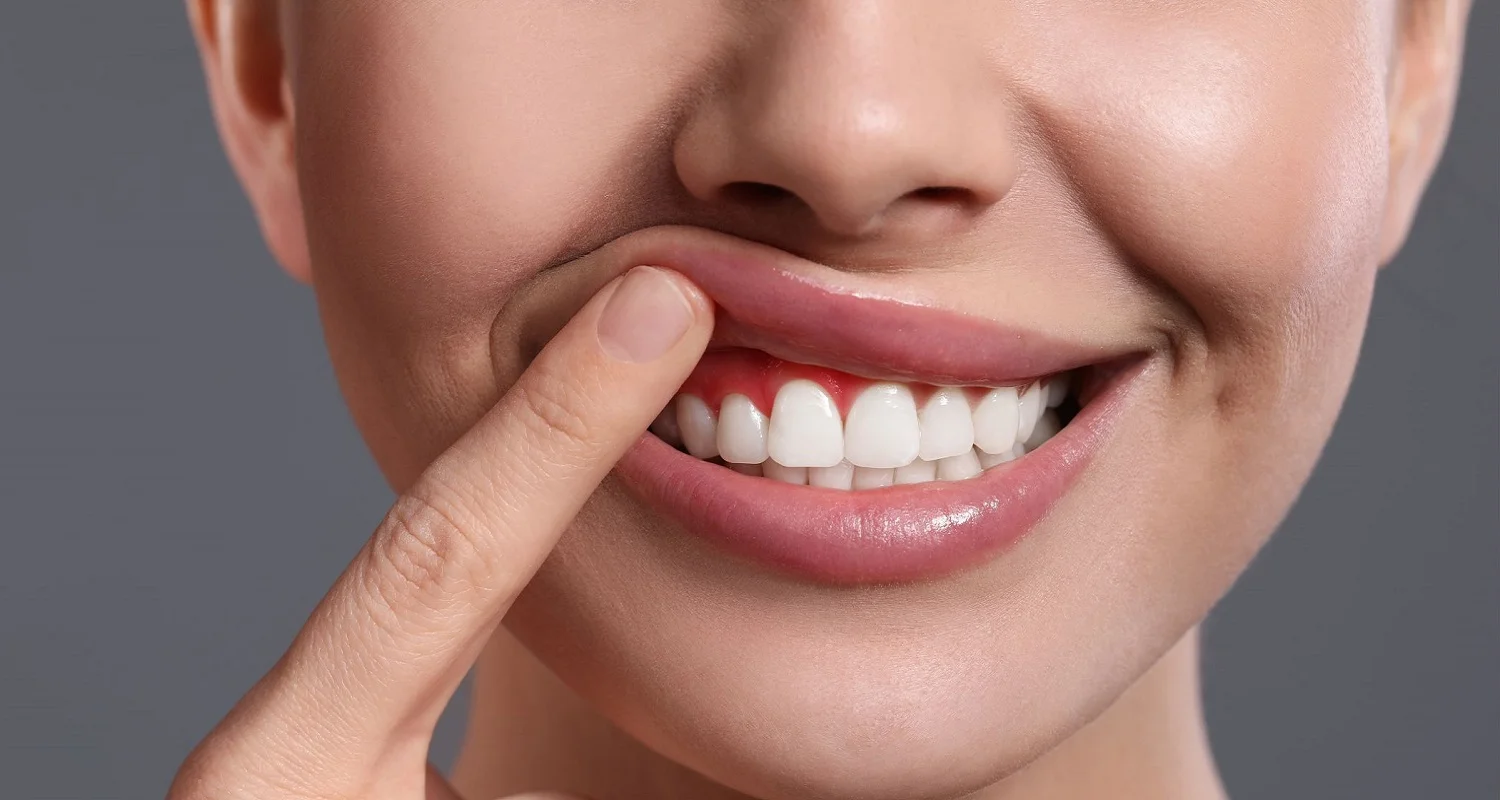 Gum Diseases: 6 Signs And Symptoms