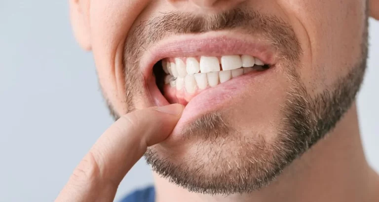 Loose Adult Tooth