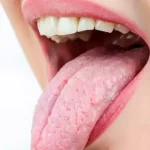 Menopausia y salud bucal