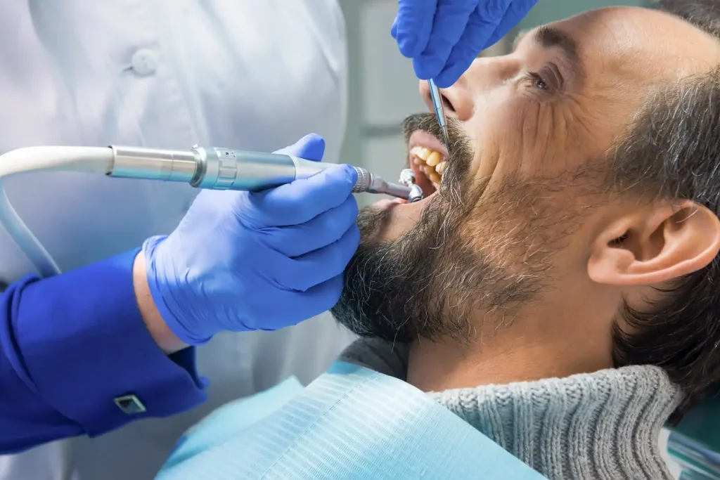 deep-cleaning-of-teeth