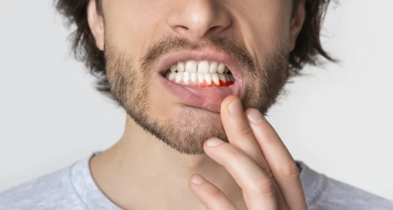 causes of itchy gums