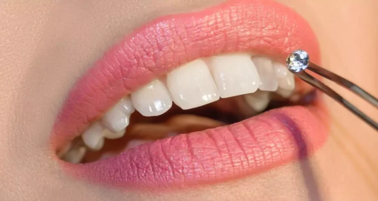 dental services