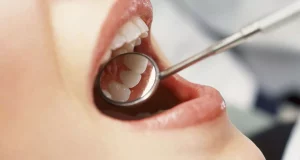 breast cancer treatment and teeth problems