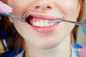 causes of itchy gums