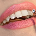 gemas dentales