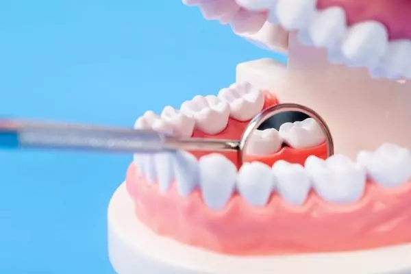 Es posible revertir las caries