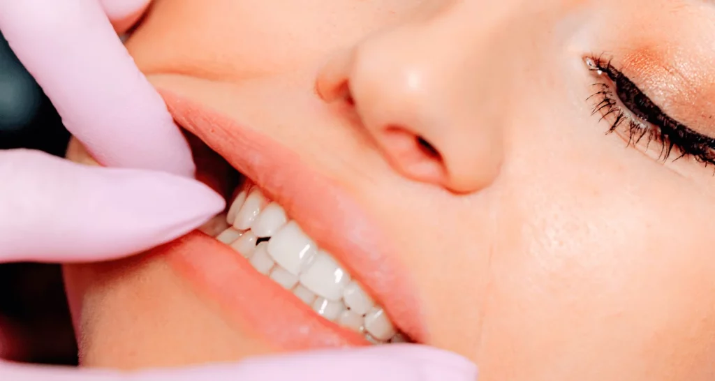 Consejos para prevenir abscesos dentales