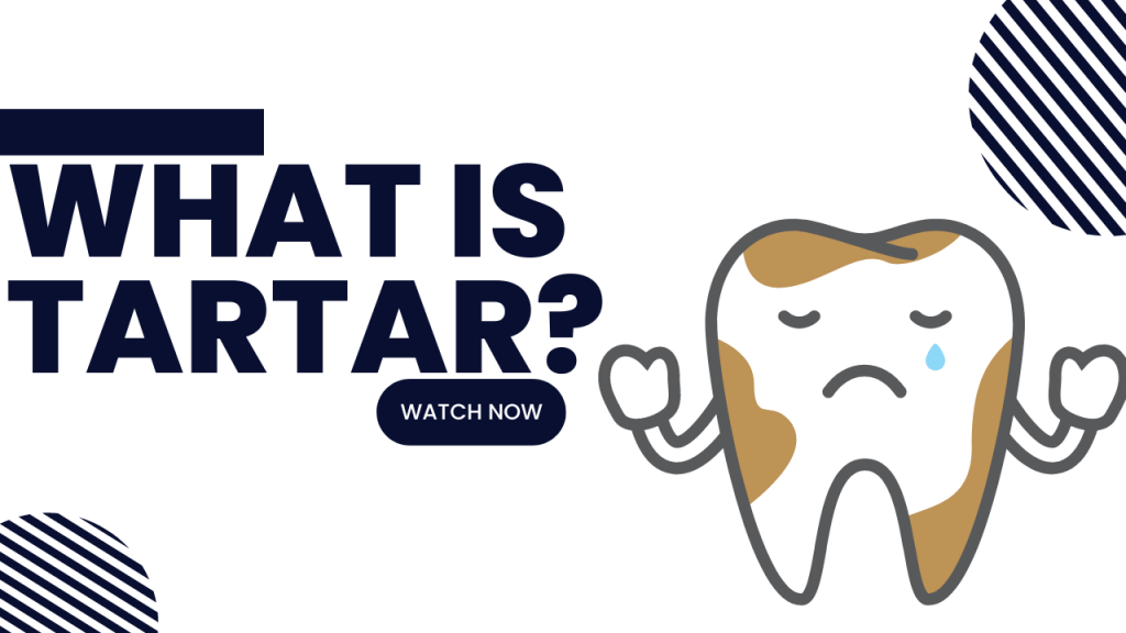 What is tartar