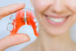 Types of Dental Retainers: 3 Best Options To Choose From