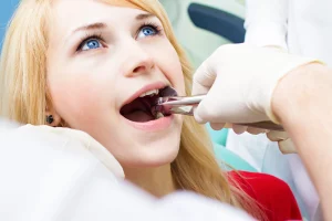 How Long Is Wisdom Teeth Removal? (Detailed Procedure)
