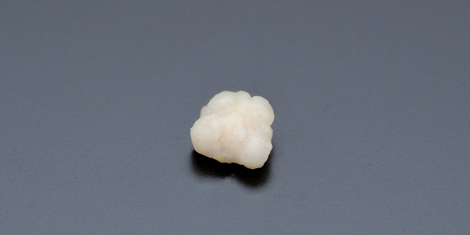 close-up on stone tonsil
