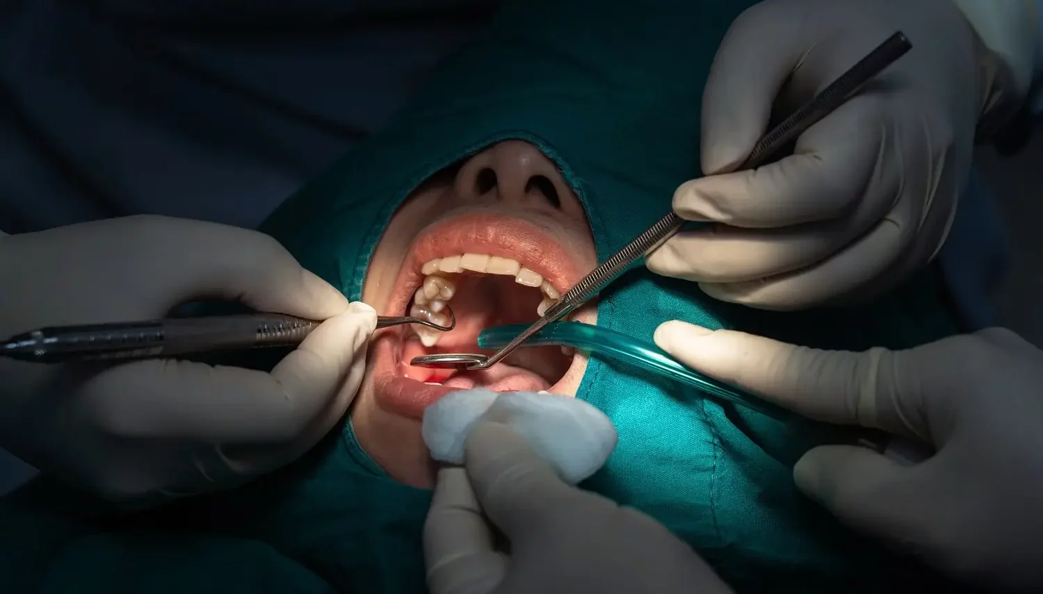 root-canal-operation