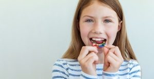 dental-plate-expansion-of-the-jaw