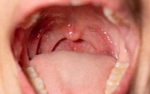 inside-of-mouth