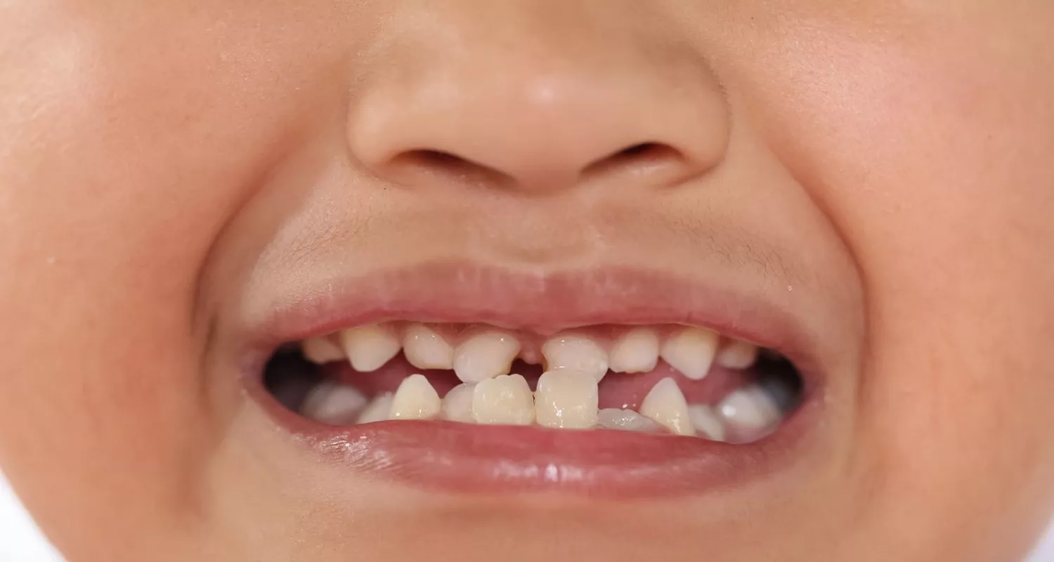 permanent tooth