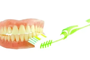 Tipos de manchas en los dientes