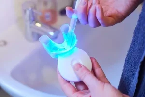 Tipos de manchas en los dientes