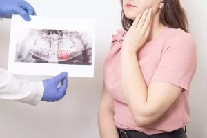 Wisdom teeth removal